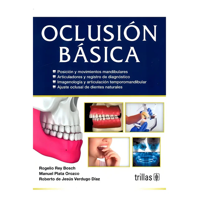 Oclusión básica