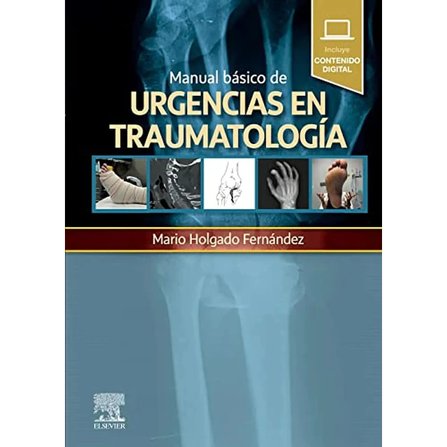 Manual básico de urgencias en traumatología
