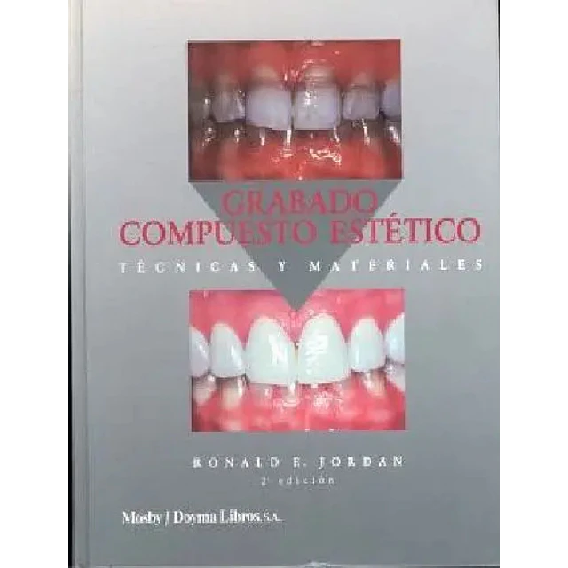 Grabado compuesto estetico : tecnicas y materiales