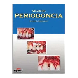 Atlas de Periodoncia