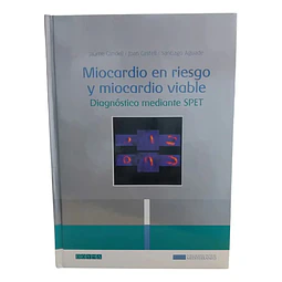 Miocardio en riesgo y miocardio viable : diagnostico mediante Spet