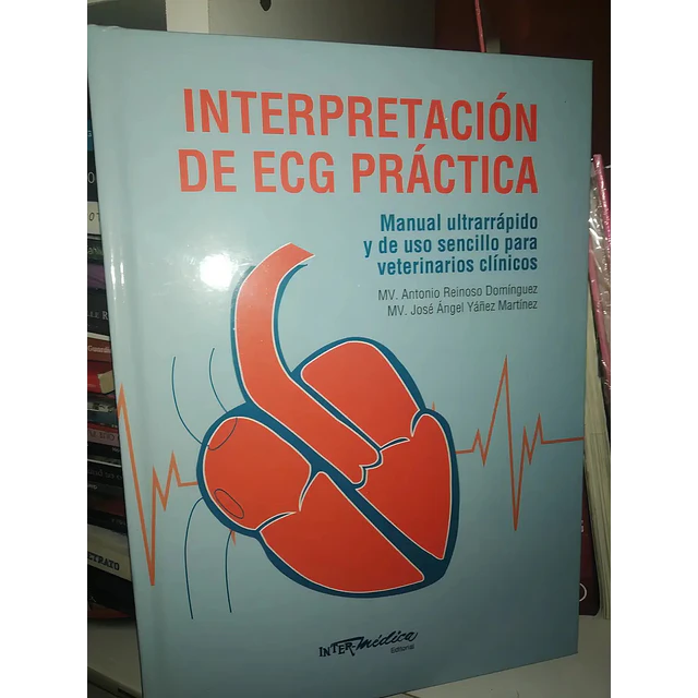 Interpretación de ECG práctica