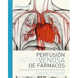 Perfusión Intravenosa de Fármacos