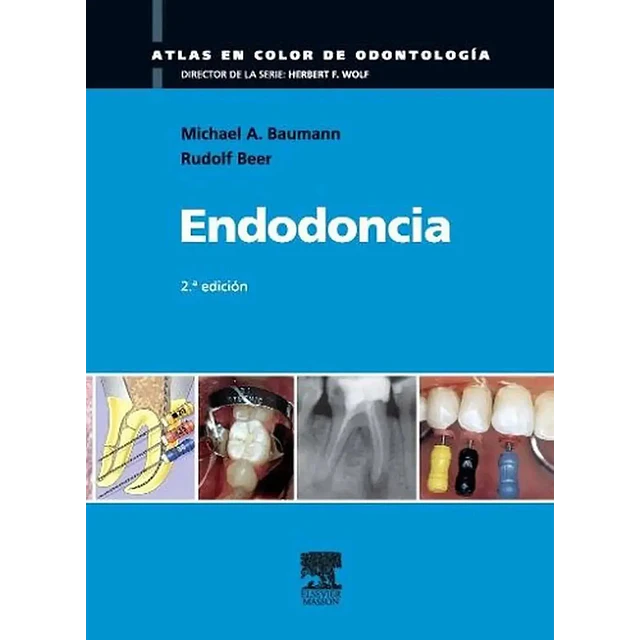 Endodoncia Atlas en color en odontología