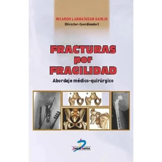Fracturas por Fragilidad