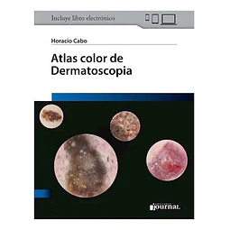 Atlas color de Dermatoscopia
