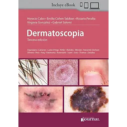 Dermatoscopia
