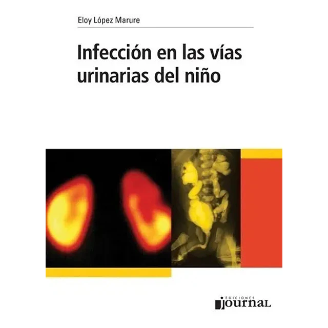Infección en las vías urinarias del niño