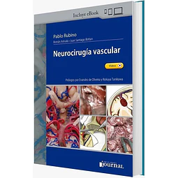 Neurocirugía vascular