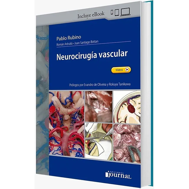 Neurocirugía vascular