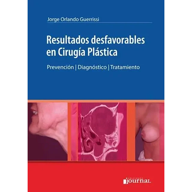 Resultados Desfavorables en Cirugía Plástica