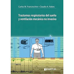 Trastornos Respiratorios del Sueño y Ventilación Mecánica No Invasiva