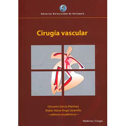 Cirugía Vascular