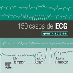 150 Casos de ECG