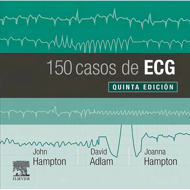 150 Casos de ECG