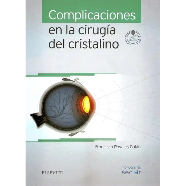 Complicaciones en la Cirugía del Cristalino