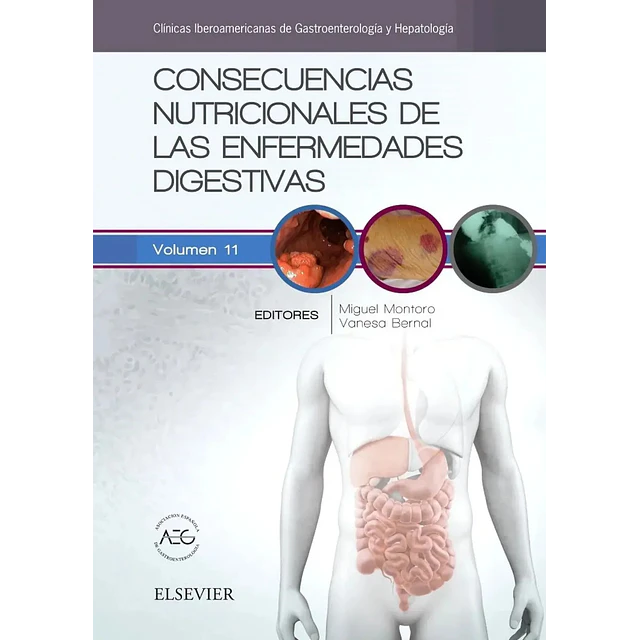 Consecuencias Nutricionales de las Enfermedades Digestivas