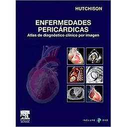 Enfermedades pericardicas con DVD