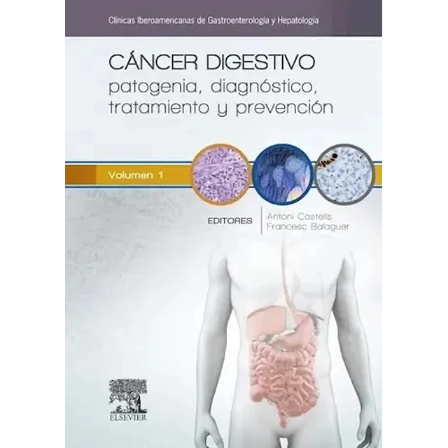 Cáncer Digestivo Vol 1