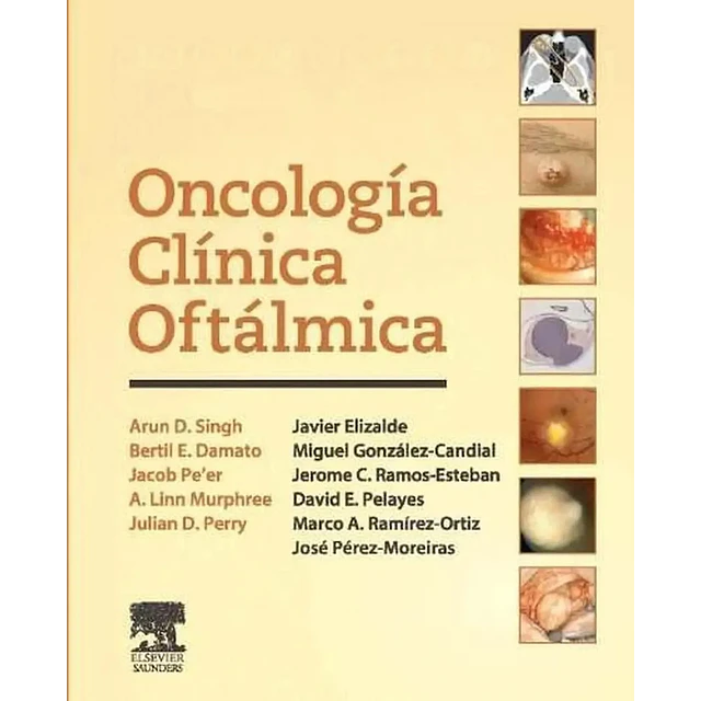 Oncologia Clinica Oftalmica