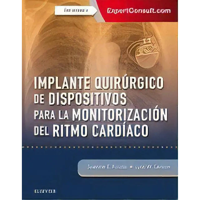 Implante Quirúrgico de Dispositivos para la Monitorización del Ritmo Cardiaco