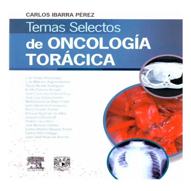 Temas Selectos de Oncología Torácica