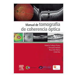 Manual de tomografía de coherencia óptica