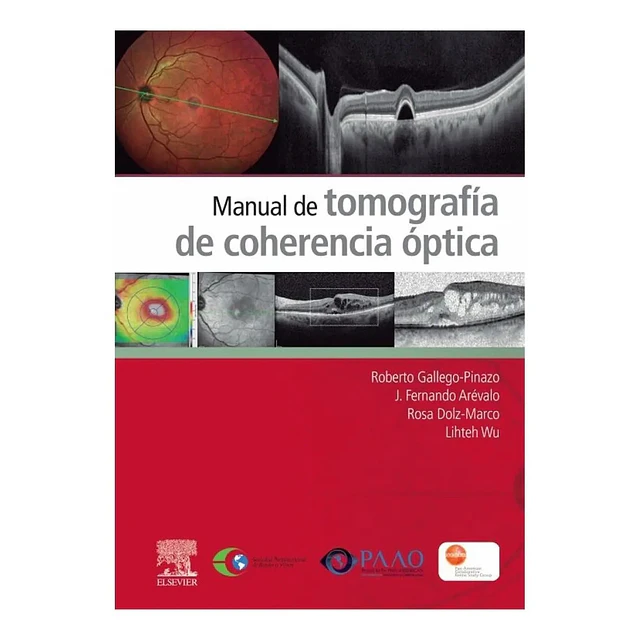 Manual de tomografía de coherencia óptica