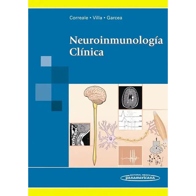 Neuroinmunología Clínica
