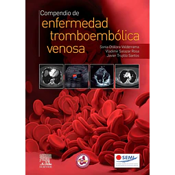Compendio de enfermedad tromboembólica venosa