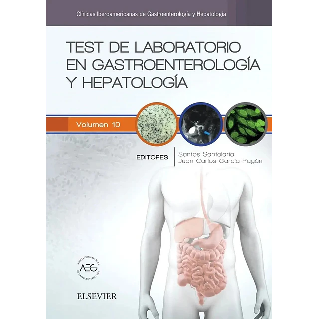 Test de Laboratorio en Gastroenterología y Hepatología