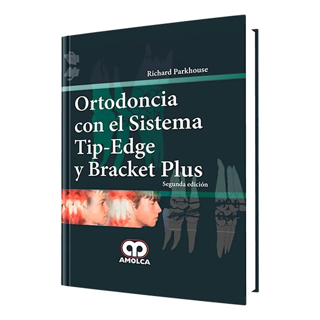 Ortodoncia con el Sistema Tip-Edge y Bracket Plus