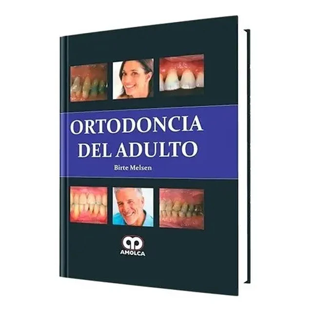 Ortodoncia del Adulto