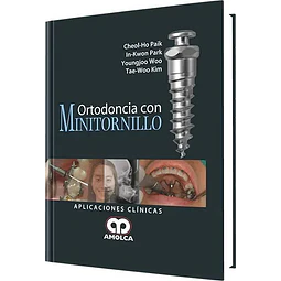 Ortodoncia con Minitornillo