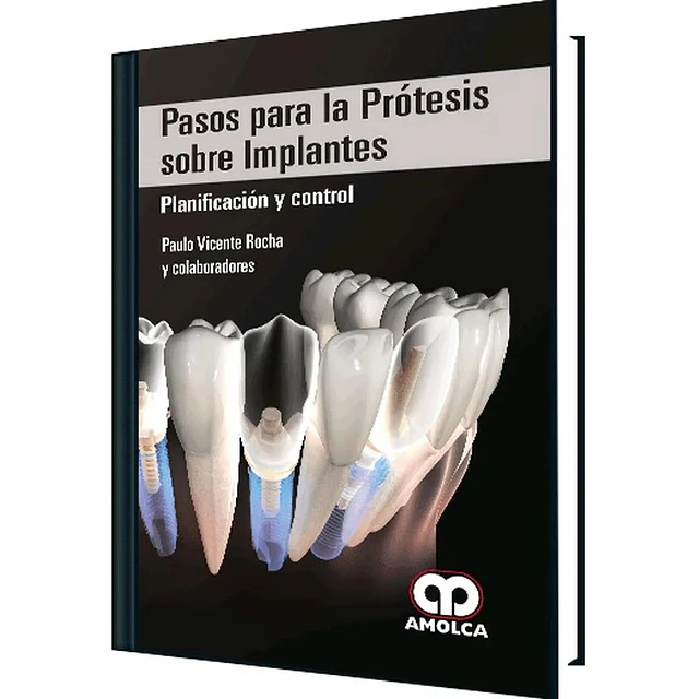 Pasos para la Prótesis sobre Implantes