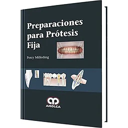 Preparaciones para Prótesis Fija