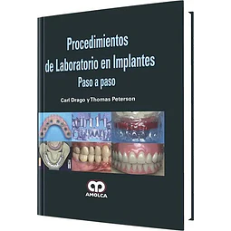 Procedimientos de Laboratorio en Implantes