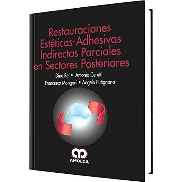 Restauraciones Esteticas-Adhesivas Indirectas Parciales en Sectores Posteriores