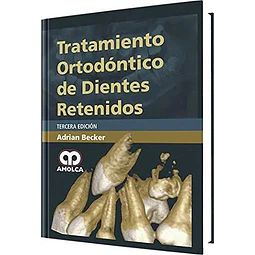 Tratamiento Ortodóntico de Dientes Retenidos
