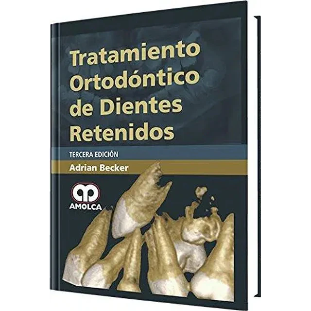 Tratamiento Ortodóntico de Dientes Retenidos