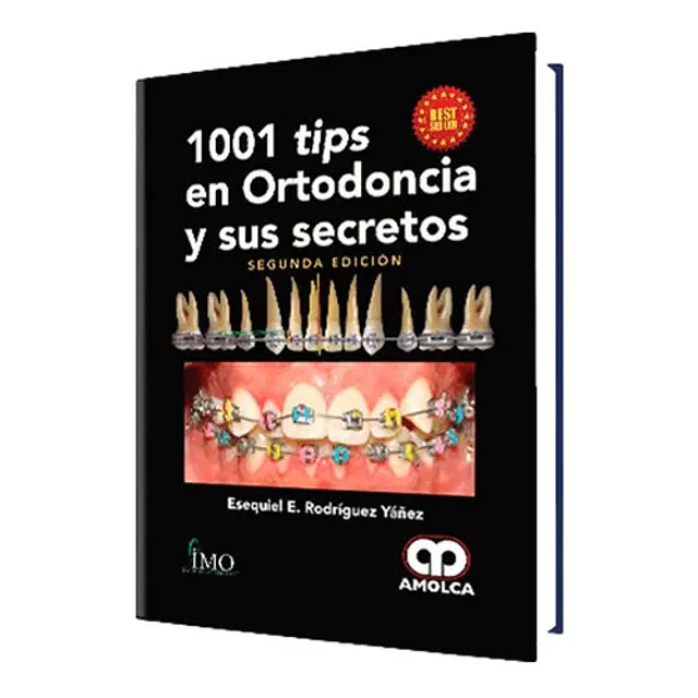 1001 Tips en Ortodoncia y sus Secretos