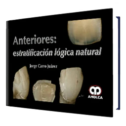 Anteriores: Estratificación Lógica Natural