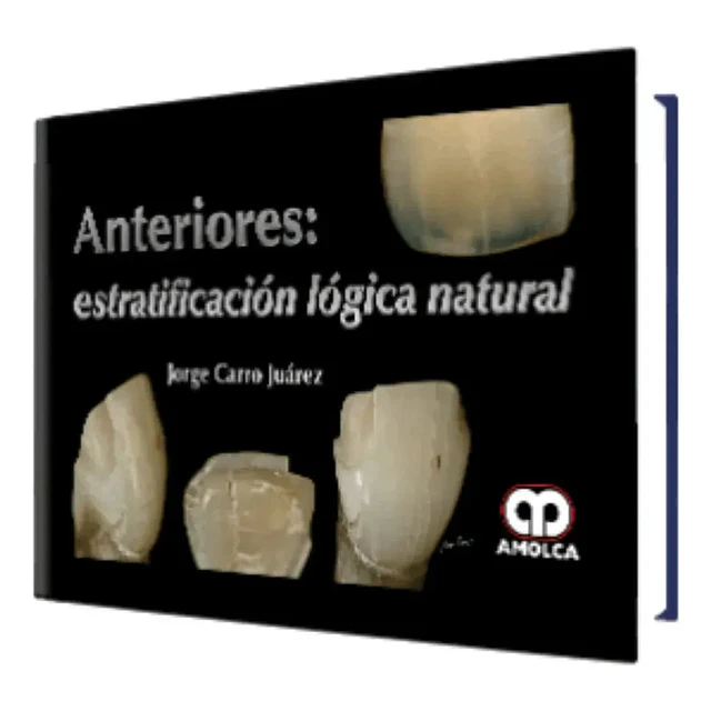 Anteriores: Estratificación Lógica Natural