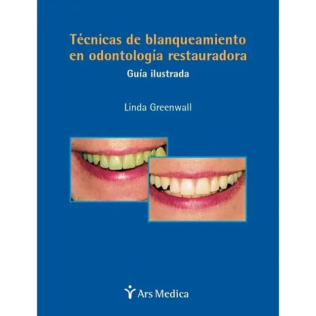 Técnicas de blanqueamiento en odontología restauradora
