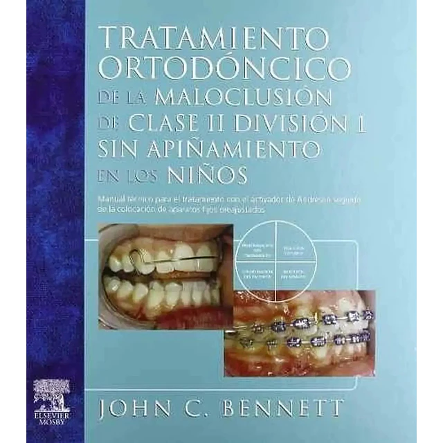 Tratamiento Ortodoncico de la maloclusión de clase II division 1 sin apiñamiento en los niños
