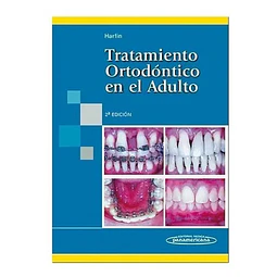 Tratamiento Ortodóntico en el Adulto