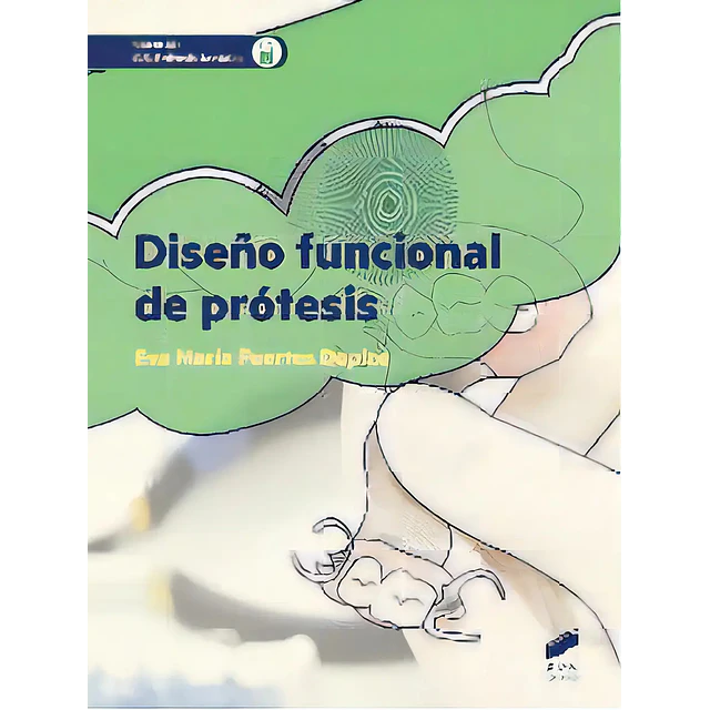 Diseño funcional de prótesis