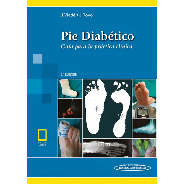 Pie diabético. Guía para la práctica clínica