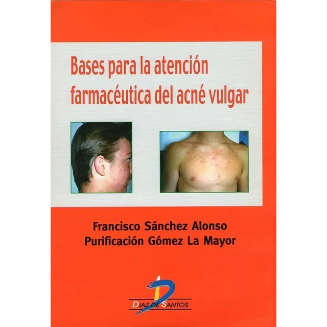 Bases para la atención farmacéutica del acné vulgar