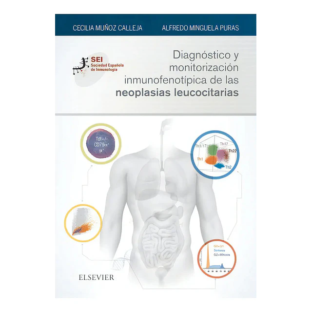 Diagnóstico y monitorización inmunofenotípica de las neoplasias leococitarias